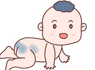 太田痣在哪些阶段可能会发展严重？